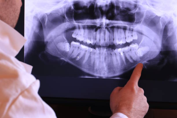 Best Emergency Dental Care for Broken or Chipped Teeth in Harpersville, AL