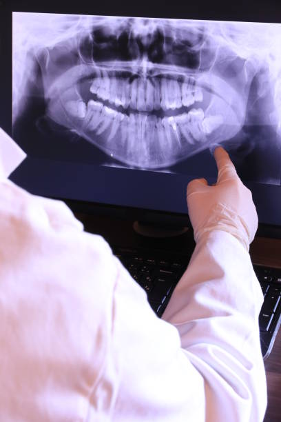 Best Emergency Denture Repair in Harpersville, AL